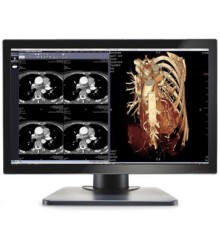 Double Black Imaging Image Systems Gemini 4MP Large Format Display